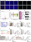 Deletion of CBX4 derepresses endogenous retroelements.