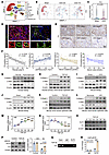 FH expression is reduced in CKD and is associated with KLF9-mediated repres