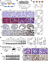 Fh1+/– mice show exacerbated renal injury and fibrosis.