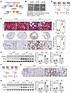 Conditional knockin of Fh1 in renal proximal tubules attenuates renal injur