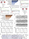 FH deficiency exacerbates renal inflammatory responses.