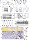 Fumarate accumulation promotes renal inflammation and fibrosis.