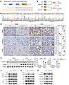 Akap12CS/CS mice are protected against UUO-induced renal inflammation and f