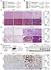 Fh1+/– mice show exacerbated liver and lung fibrosis, whereas AAV2/9-mediat