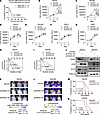 FAM3C promotes GSC proliferation and portends a poor prognosis.