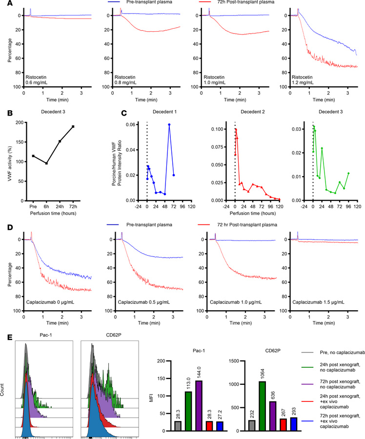 Analysis of VWF during post-extracorporeal liver cross-circulation.
(A) ...