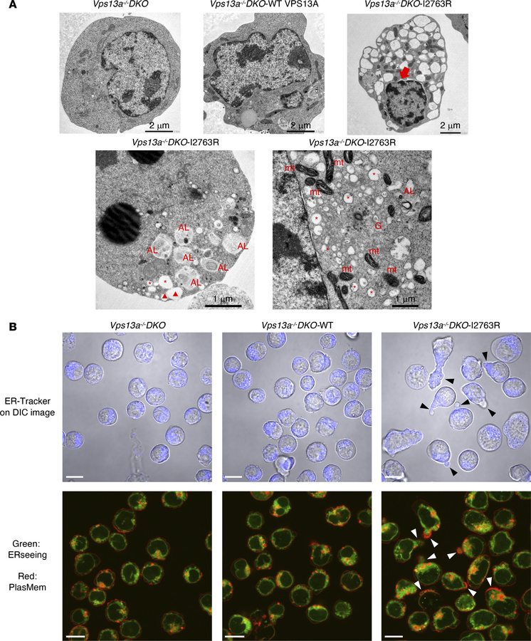 Damaged ER in cells expressing the I2763R mouse VPS13A mutant.
(A) Trans...