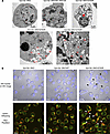 Damaged ER in cells expressing the I2763R mouse VPS13A mutant.