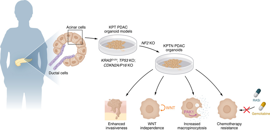 The role of NF2 inactivation in PDAC.
Using healthy human pancreatic aci...