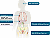 Predominant sites and characteristics of mHSPC metastases.