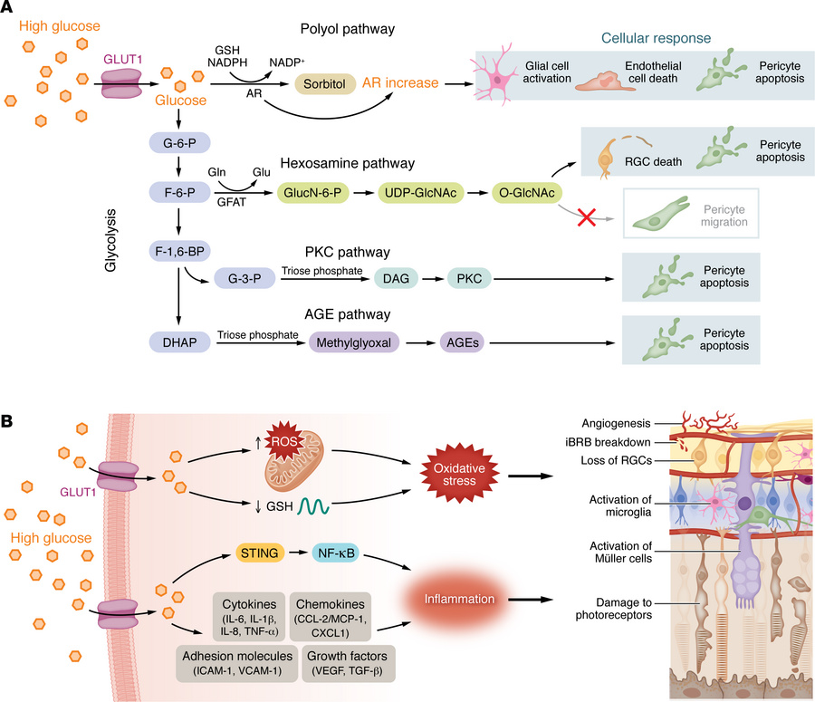 Pathological process in diabetic retinopathy.
(A) Schematic diagram of d...