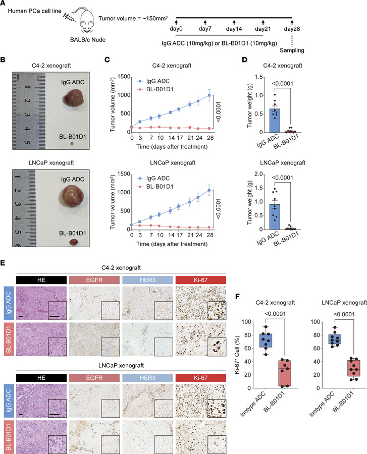 Antitumor activity of BL-B01D1 in human prostate cancer cell line models...