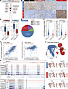 Distinct expression patterns of EGFR and HER3 across CRPC subtypes and thei