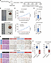 Antitumor activity of BL-B01D1 in human prostate cancer cell line models in