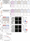 Antitumor activity of BL-B01D1 in PDO models.