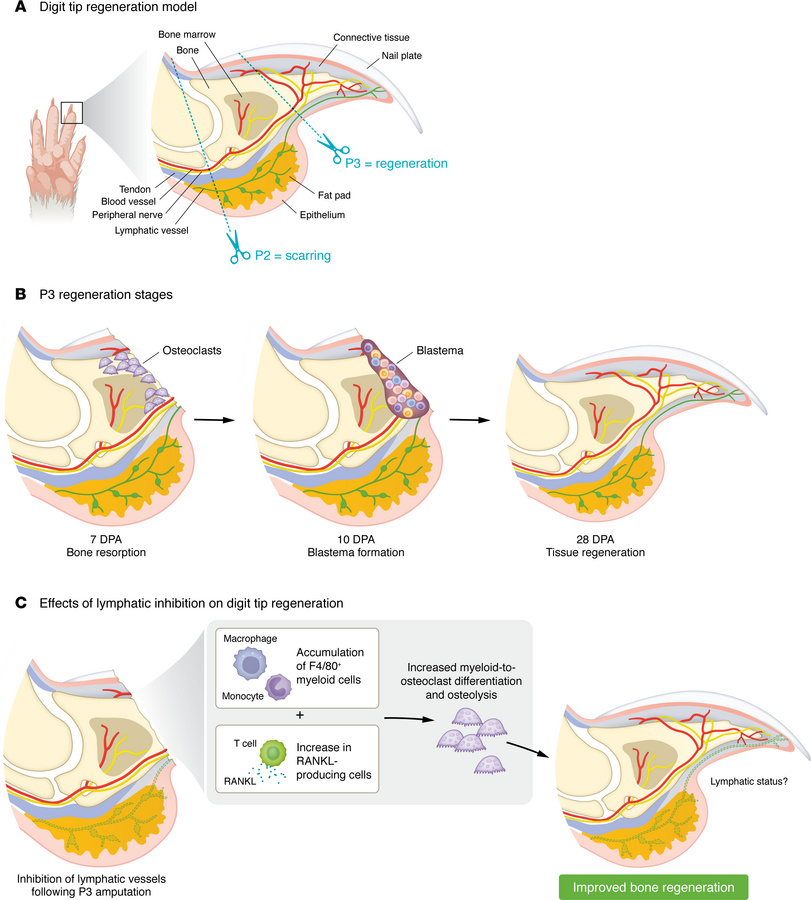 Lymphatic ablation promotes regeneration in a P3 digit amputation model....