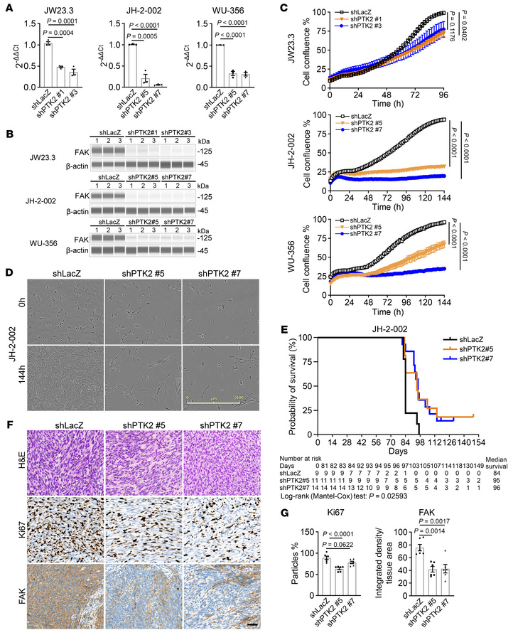 Knockdown of PTK2 inhibits cell proliferation and tumorigenesis of MPNST...