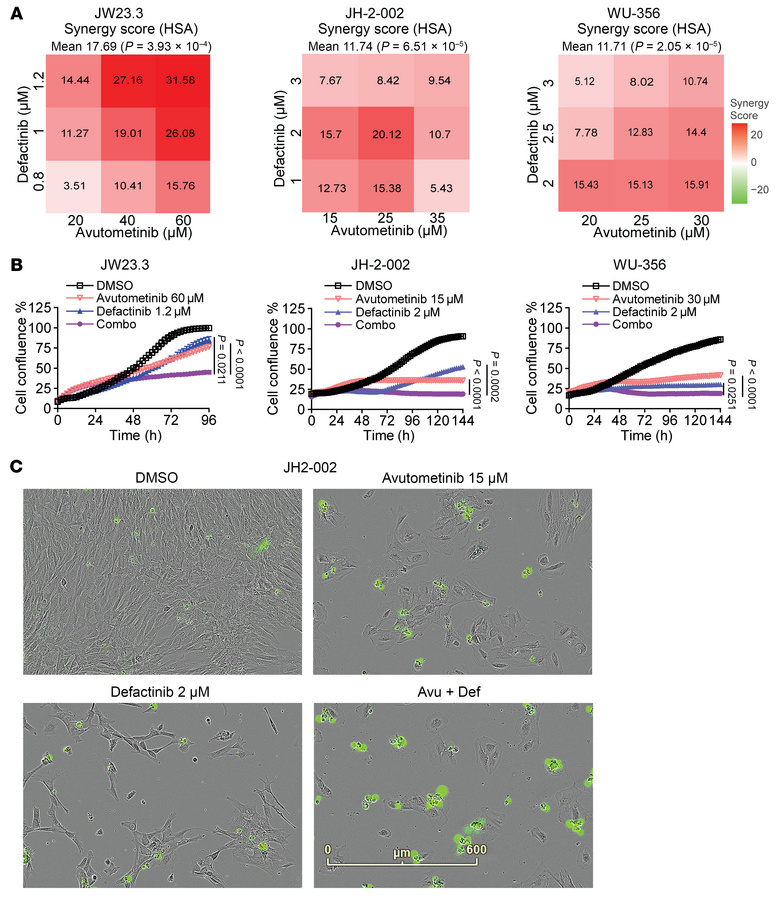 The combination of a FAKi and a RAF/MEKi is synergistic in decreasing pr...