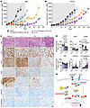 Combination of FAKi with RAF/MEKi decreases tumor growth in chr8 gain PDX m