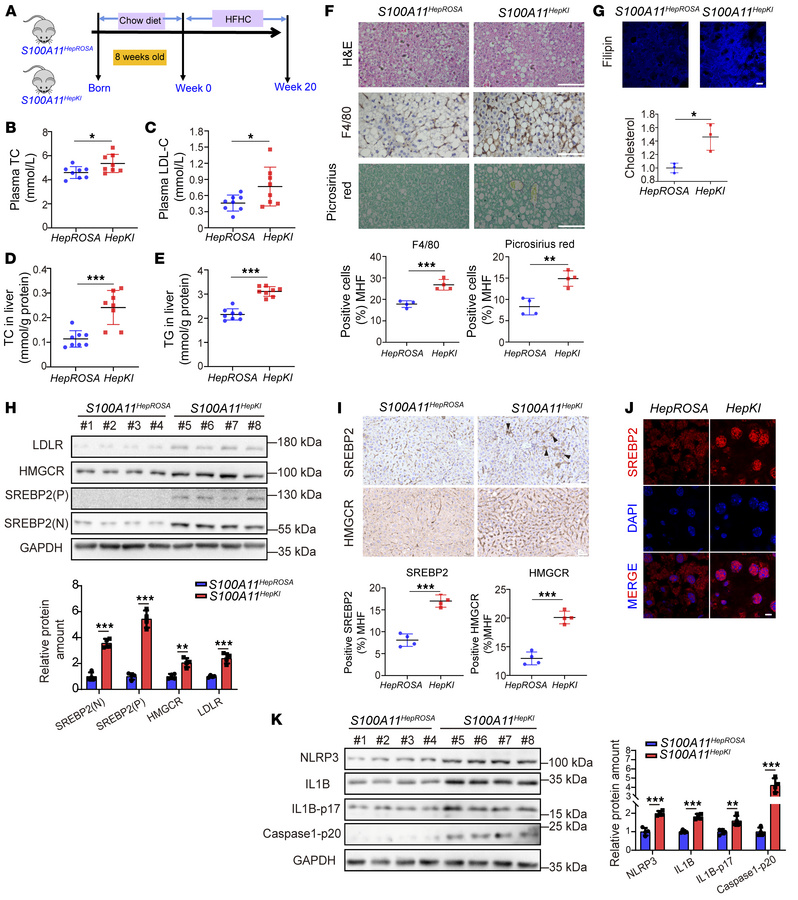 Hepatic overexpression of S100A11 promotes hepatic cholesterol accumulat...