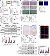Hepatic overexpression of S100A11 promotes hepatic cholesterol accumulation