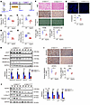 Hepatic KO of S100A11 alleviates hepatic cholesterol accumulation and MASH.