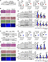 In vivo inhibition of SREBP2 signaling alleviates S100A11-promoted hepatic