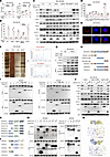 FBXW5 modulates type I IFN signaling via physical interaction with RIGI and