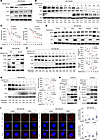 FBXW5 orchestrates autophagic degradation of RIGI/MDA5 proteins.