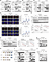 FBXW5 bridges RLRs to SQSTM1 for autophagic degradation.