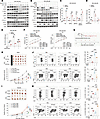 FBXW5 inhibits chemotherapy efficacy by blunting type I IFN signaling.