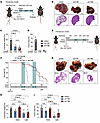 YAP/TAZ inhibition is beneficial in advanced CCA.
