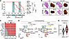 The therapeutic effect of YAP/TAZ depletion depends on CD8+ cytotoxic T cel