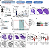 Tgfb2 is a critical target of the oncogenic program driven by YAP/TAZ.