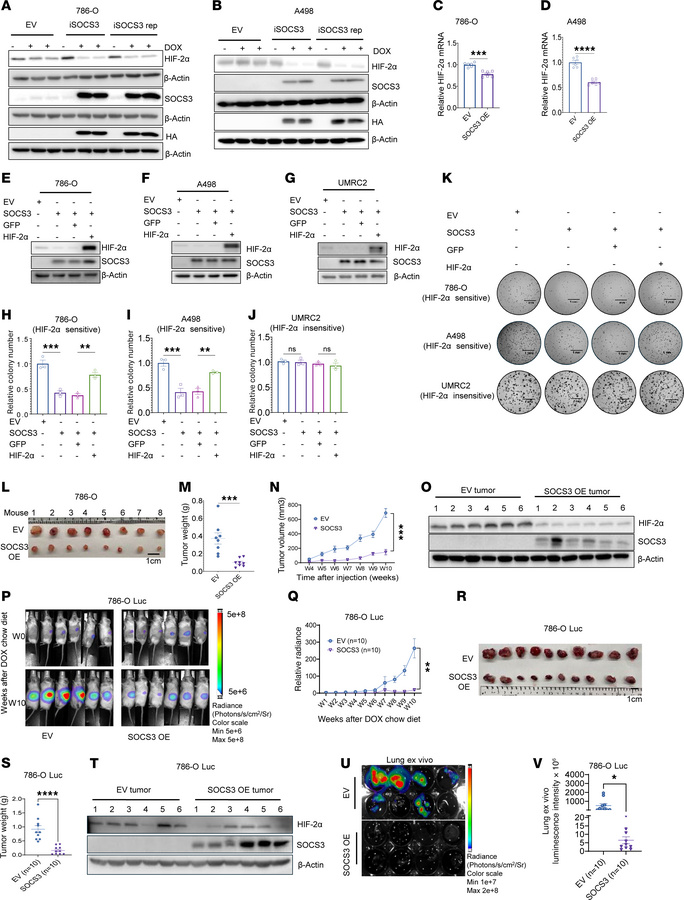 SOCS3 overexpression suppresses HIF-2α levels and inhibits ccRCC tumorig...