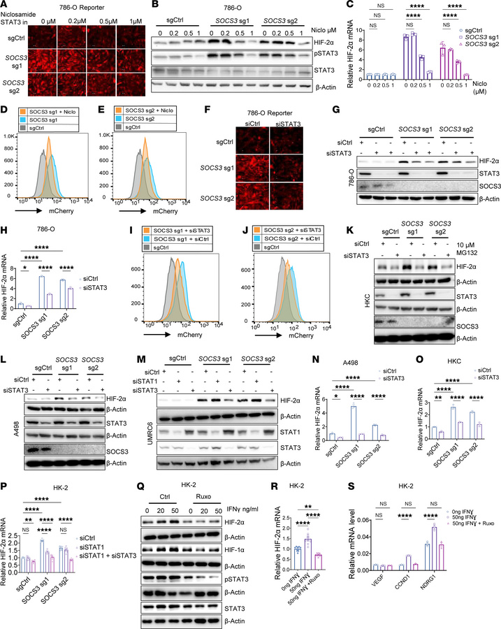 STAT3 mediates the effect of SOCS3/JAK1 on HIF-2α expression.
(A–C) Repr...