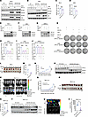 SOCS3 overexpression suppresses HIF-2α levels and inhibits ccRCC tumorigene