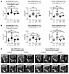 Choline diet increases the LA size during diastolic and systolic function.
