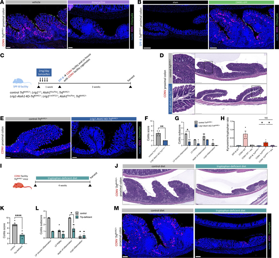 Perturbation of the IDO1 pathway reduces Chlamydia-driven PC inflammatio...