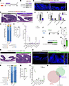C. muridarum is necessary and sufficient to drive PC inflammation in the Tn