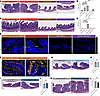 PC inflammation is independent of inflammation and secretory function of th