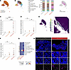 Epithelial IDO1 is upregulated in human CD with active AC inflammation.