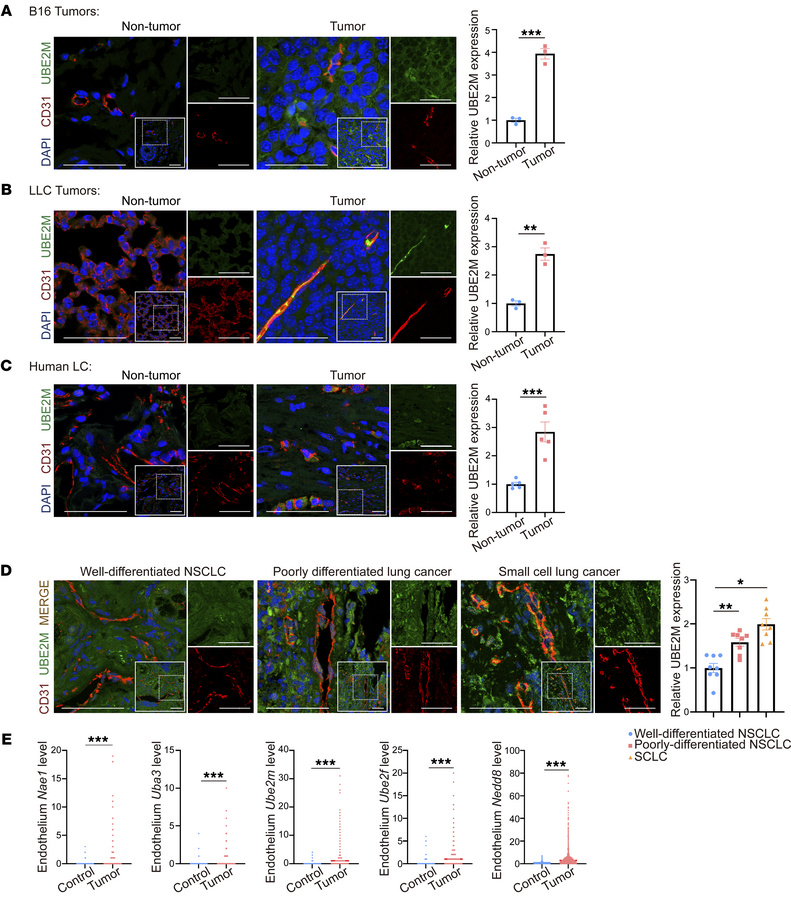 UBE2M is highly expressed in tumor endothelial cells.
(A and B) Represen...