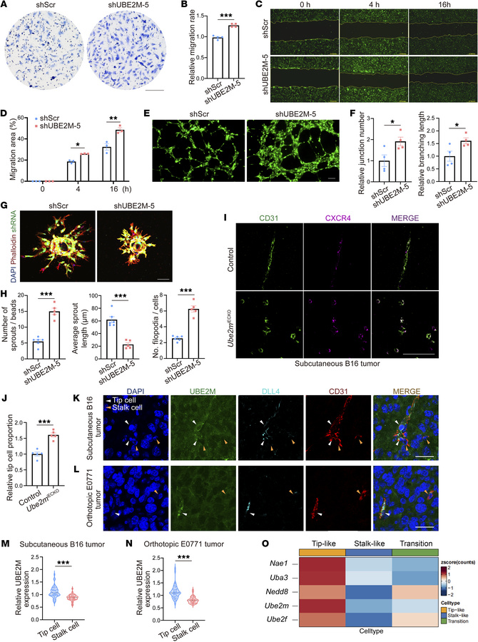 UBE2M deficiency in endothelial cells leads to excessive tip cell induct...