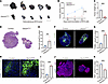 Endothelial UBE2M deletion suppresses tumor growth.
