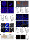 Endothelial deletion of UBE2M promotes nonproductive angiogenesis.