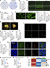 UBE2M deficiency in endothelial cells leads to excessive tip cell induction