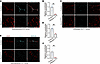 UBE2M deficiency reduces DLL4 expression in tumor endothelial cells.