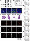 DLL4 reexpression in tumor endothelial cells restored tumor growth and vasc