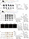 Targeting endothelial UBE2M inhibits tumor growth and sensitizes to anti-VE